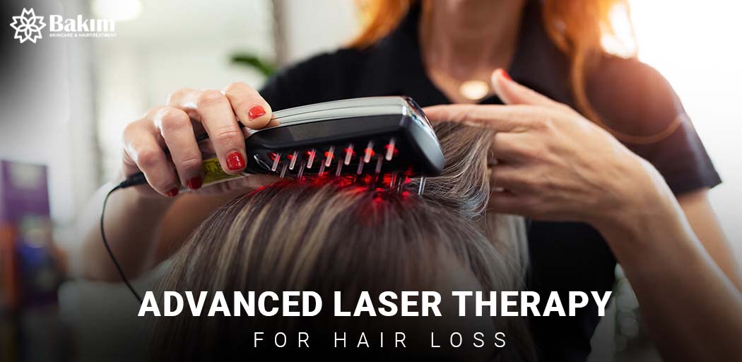 Laser Therapy for Hair