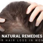 Natural remedies for hair loss in women