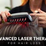 Advanced Laser Therapy for Hair Loss