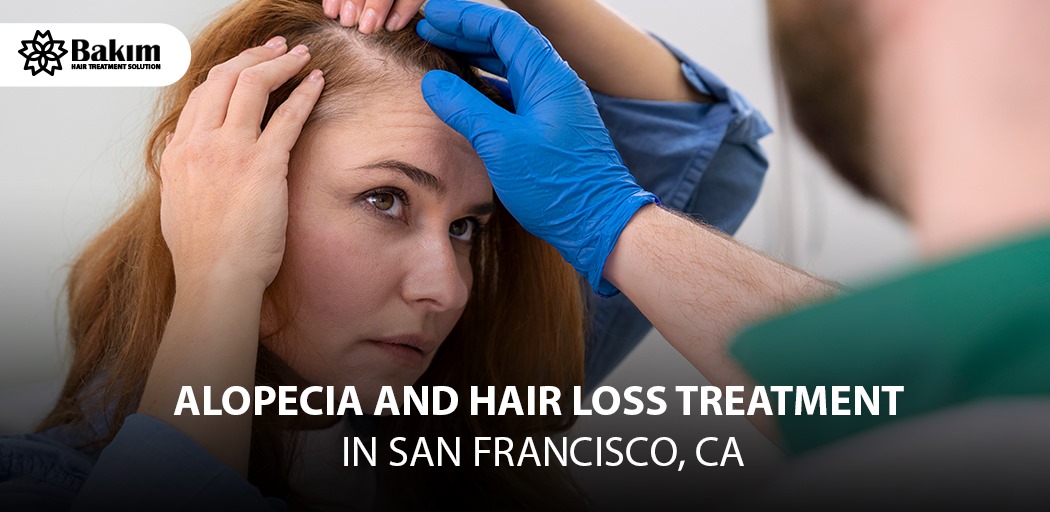 Alopecia and Hair Loss Treatment in San Francisco, CA